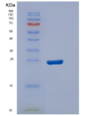 Recombinant Human DUSP13 Protein