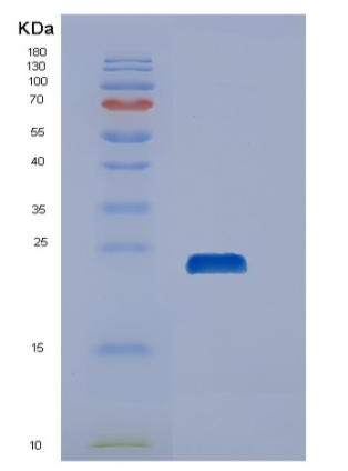 Recombinant Human DUSP21 Protein