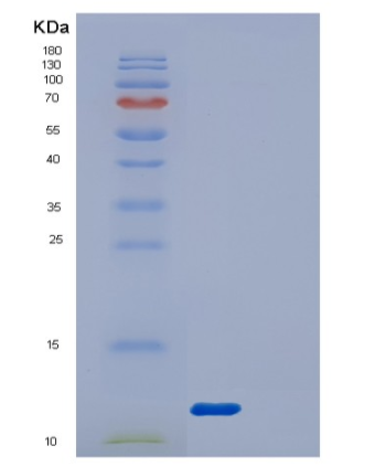 Recombinant Human DYNLRB1 Protein