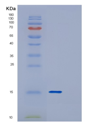 Recombinant Human DYNLT3 Protein
