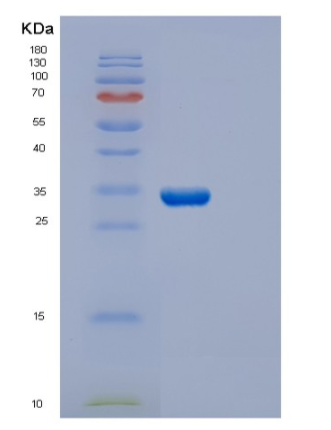 Recombinant Human ECH1 Protein