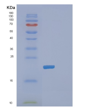 Recombinant Human DHFR Protein