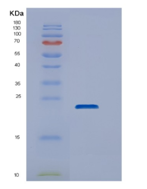 Recombinant Human DUSP22 Protein