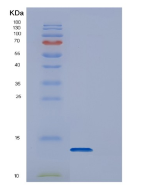 Recombinant Human DYNLL1 Protein