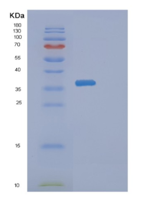 Recombinant Human DIMT1 Protein