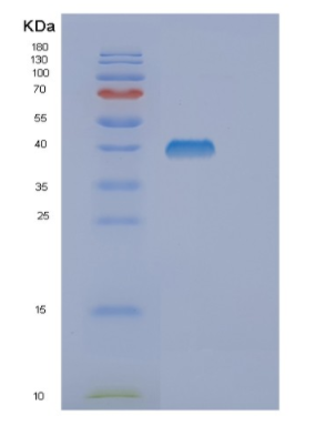 Recombinant Human DUSP10 Protein