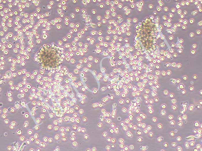 NOMO-1人白血病细胞