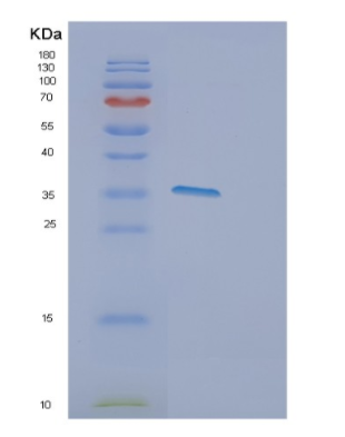 Recombinant Human DPPA4 Protein