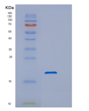 Recombinant Human DSTN Protein