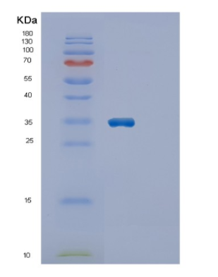 Recombinant Human ECHDC1 Protein