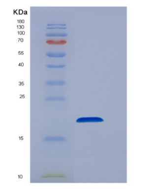 Recombinant Human EEF1E1 Protein