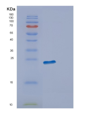 Recombinant Human ECSIT Protein