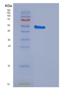 Recombinant Human EED Protein