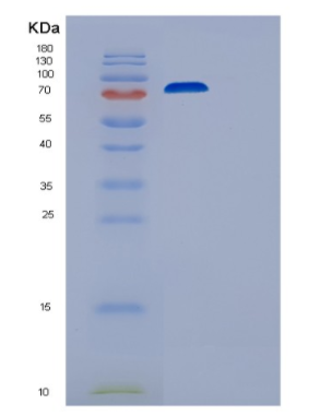 Recombinant Human EEF2K Protein