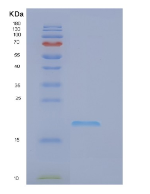 Recombinant Human EIF1AY Protein