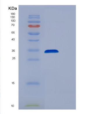 Recombinant Human EEF2 Protein