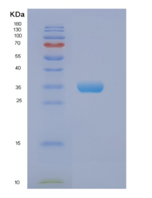 Recombinant Human EIF2B1 Protein