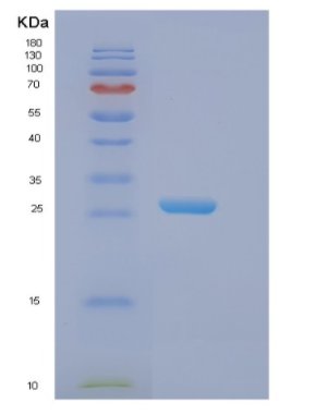 Recombinant Human EIF3K Protein