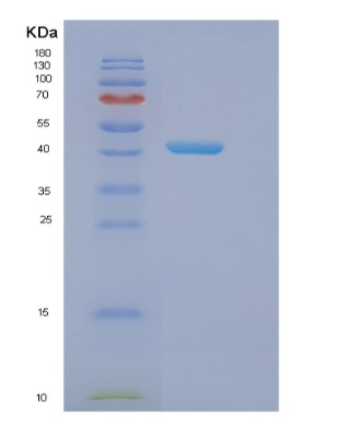Recombinant Human EIF4A3 Protein