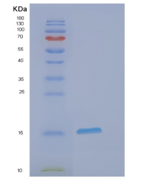 Recombinant Human EIF1 Protein