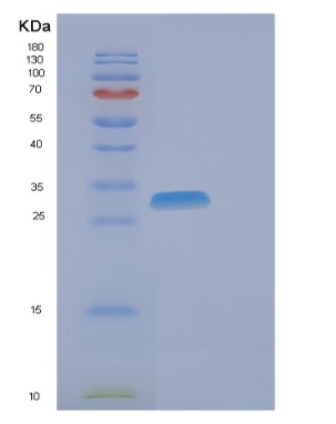 Recombinant Human EIF4H Protein