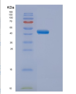 Recombinant Human ELP4 Protein