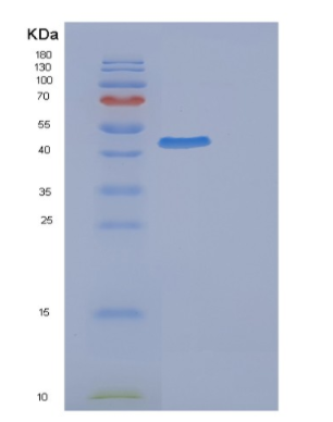Recombinant Human EPHX1 Protein