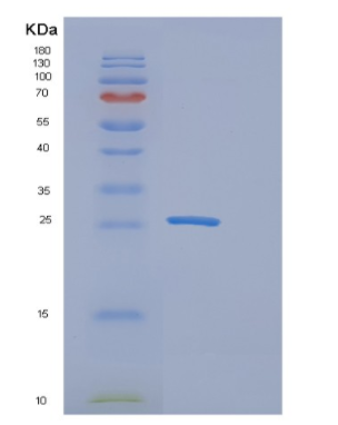 Recombinant Human EPOR Protein