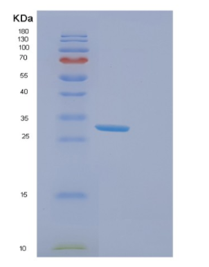 Recombinant Human ERCC1 Protein