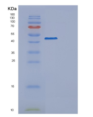 Recombinant Human ERP44 Protein