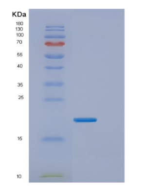 Recombinant Human ESM1 Protein