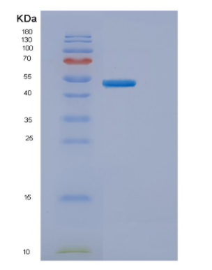 Recombinant Human ENTPD3 Protein