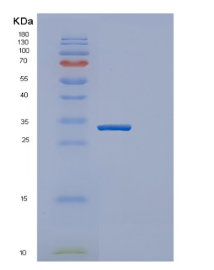 Recombinant Human Esterase D Protein