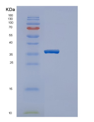 Recombinant Human Estrogen Sulfotransferase Protein