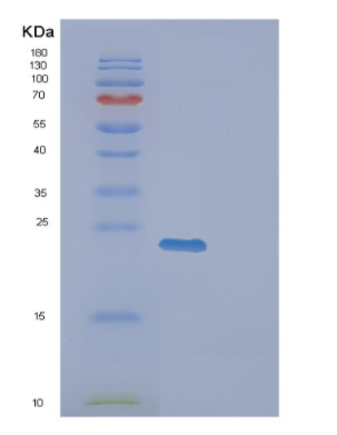 Recombinant Human EXOSC1 Protein
