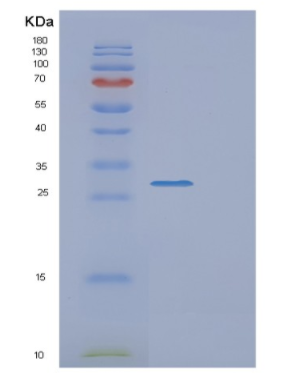 Recombinant Human EXOSC4 Protein