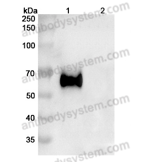 Anti-Human CD333/FGFR3 Antibody (B-701) (FHD52910)