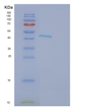 Recombinant Human FBLIM1 Protein