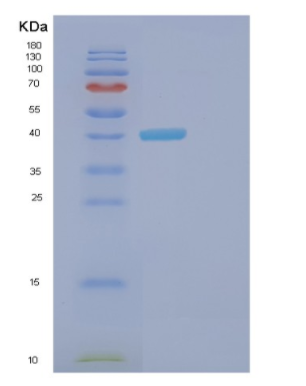 Recombinant Human FGB Protein