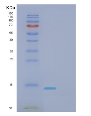 Recombinant Human FKBP1B Protein