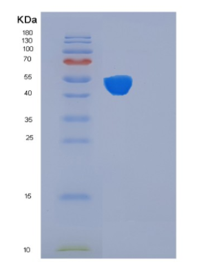 Recombinant Human FKBP4 Protein