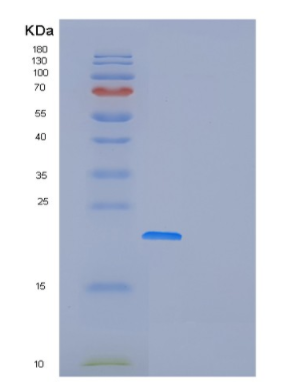 Recombinant Human FOPNL Protein