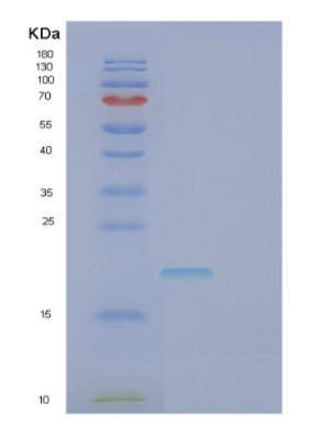 Recombinant Human FASLG Protein