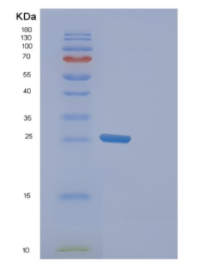 Recombinant Human FAM50A Protein
