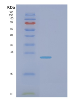 Recombinant Human FCGR2B Protein