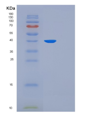 Recombinant Human FKBP6 Protein