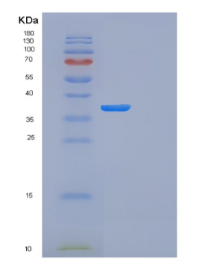 Recombinant Human FN3KRP Protein