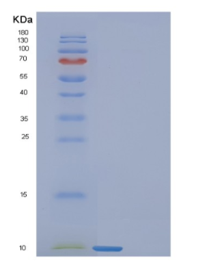Recombinant Human FANK1 Protein