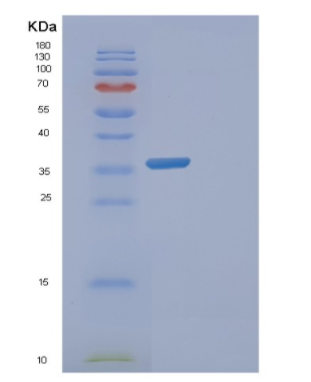 Recombinant Human FAM84B Protein