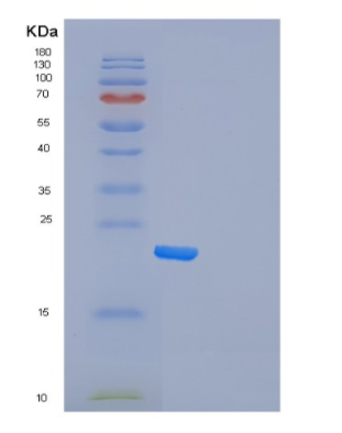 Recombinant Human Frataxin Protein